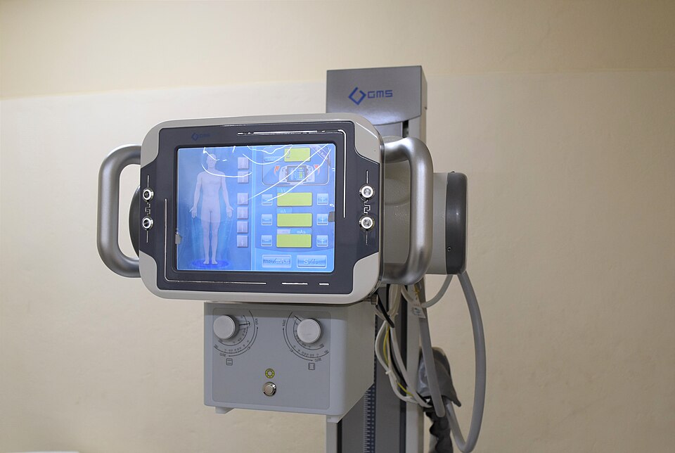 A medical device with a screen showing a human body and some diagnostics